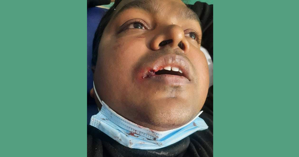 जलेश्वर अस्पतालका मेसु डा.सतिश साह माथि कुटपिट गर्नेलाई कडा कारबाही गर्न माग